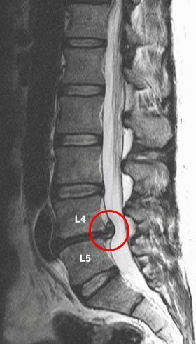 Почему у меня болит спина с правой стороны