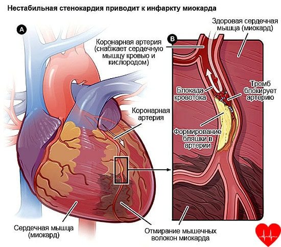 Почему у меня болит спина с правой стороны