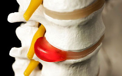 болит спина и отдает в пах у женщин