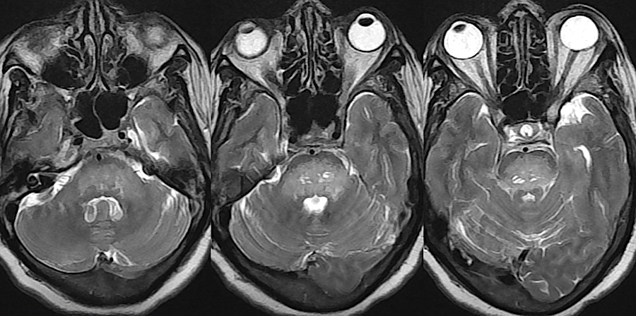 Почему болит голова и глаза
