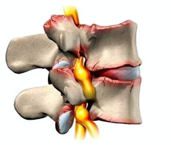 из за чего болит спина у девушки с левой стороны