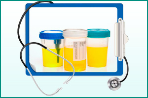 Бакпосев мочи Анализ мочи