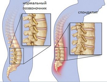 Болит воротниковая зона и голова