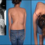 Болит под грудной клеткой и отдает в спину