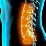 Как вправить спину болит спина