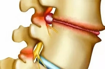 Если при наклоне головы болит спина