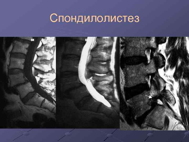 Если болит копчик когда сидишь или лежишь на спине